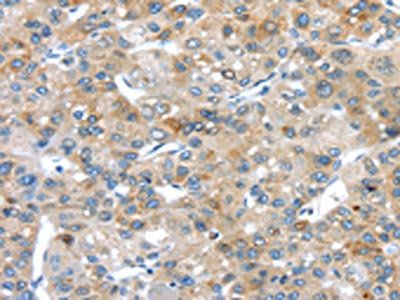 PLXNA3 Antibody