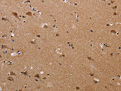 PLXNA4 Antibody