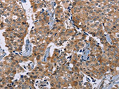 PLXNA4 antibody