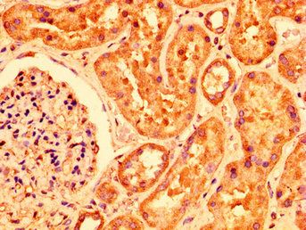 PLXNB1 Antibody