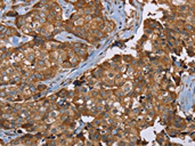 PLXNB1 Antibody