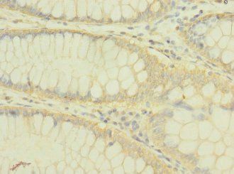PLXNB2 Antibody