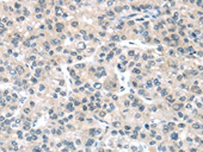 PLXNB2 Antibody
