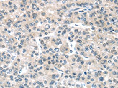 PLXNB2 antibody