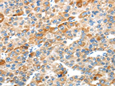 PLXNB2 Antibody