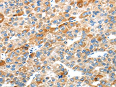 PLXNB2 antibody