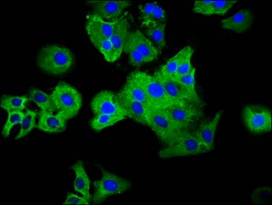 PLXNC1 antibody