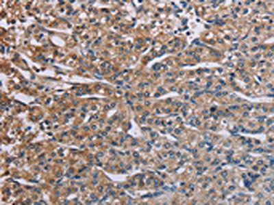 PLXND1 Antibody