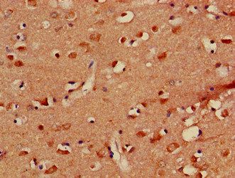 PLXND1 Antibody