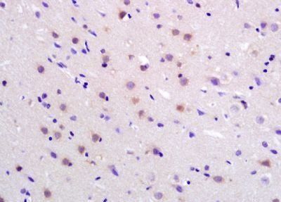 PMCA4B Rabbit Polyclonal Antibody