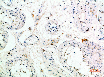 PMCH Antibody