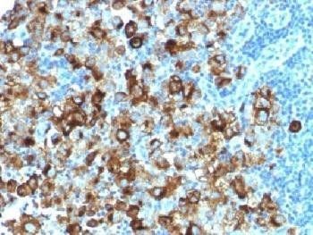 PMEL17 / Melanoma gp100 Antibody