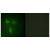 PMEPA1 Antibody