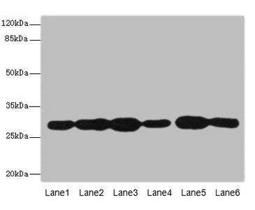 PMM2 Antibody