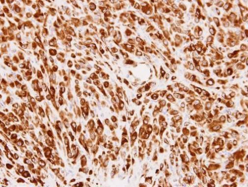 PMM2 Rabbit Polyclonal Antibody