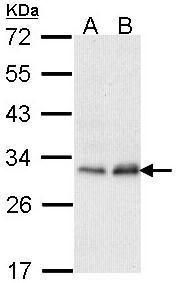 PMM2 Rabbit Polyclonal Antibody