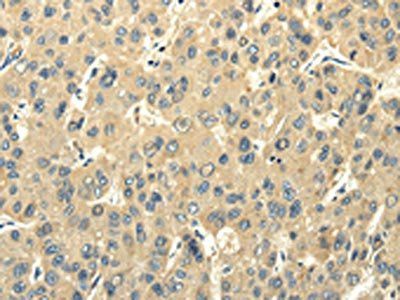 PMP2 Antibody