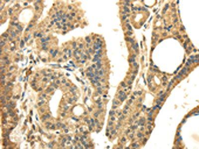 PMP2 Antibody