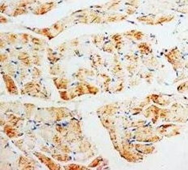 Anti-Phosphomevalonate kinase PMVK Antibody
