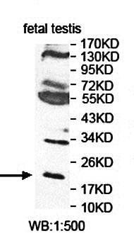 PMVK Rabbit Polyclonal Antibody