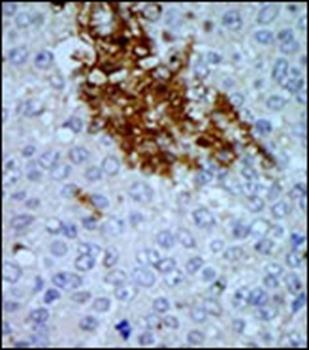 PNCK antibody