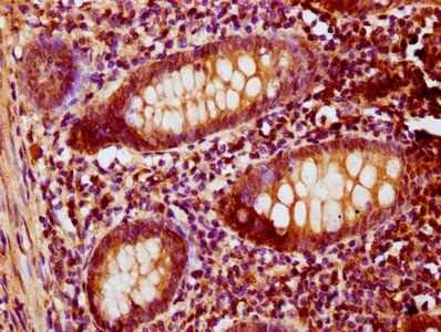 PNCK Antibody