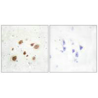 PNCK Antibody