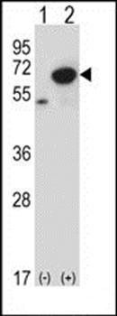 PNKP antibody