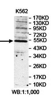 PNLIPRP1 Rabbit Polyclonal Antibody