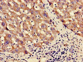 PNLIPRP3 Antibody