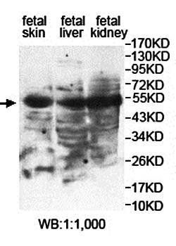 PNLIPRP3 antibody