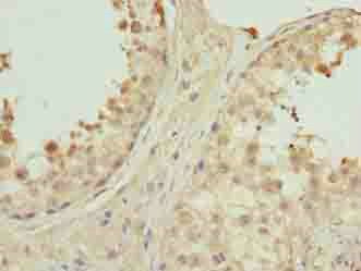 PNMA1 Antibody