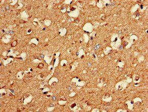 PNMA2 Antibody