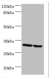 PNP antibody