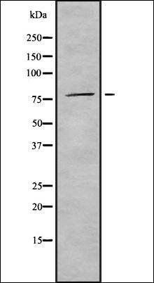 PNPase antibody