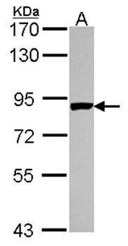 PNPase antibody