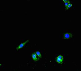 PNPLA1 antibody