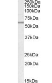Goat anti-ATGL / Desnutrin Antibody