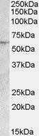 Goat anti-PNPLA2 / Desnutrin Antibody