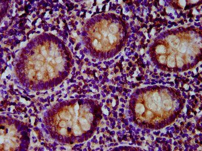 PNPLA5 Antibody