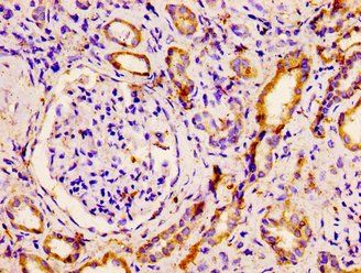 PNPLA6 Antibody