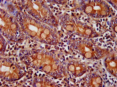 PNPLA8 Antibody