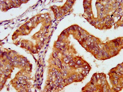 PNPO Antibody