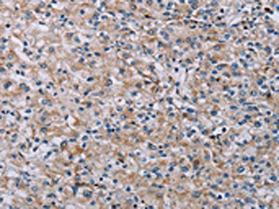 PNPT1 Antibody