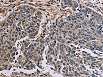 PNPT1 Antibody