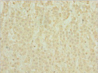 POC1A Antibody