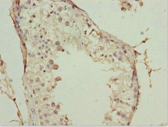 POC1A Antibody