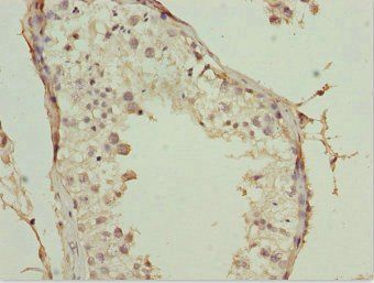 POC1A antibody