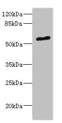 POC1B antibody