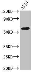 Podocalyxin antibody